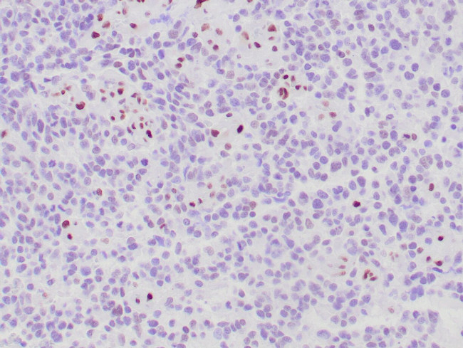 ATRX Antibody in Immunohistochemistry (Paraffin) (IHC (P))