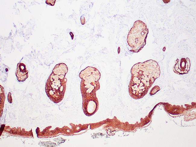 Cytokeratin, HMW Antibody in Immunohistochemistry (Paraffin) (IHC (P))