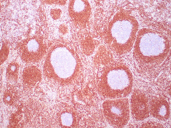 BCL-2 Antibody in Immunohistochemistry (Paraffin) (IHC (P))