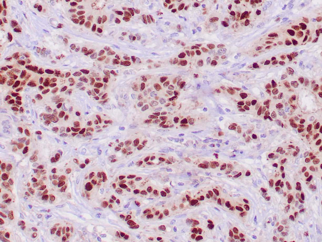 PR Antibody in Immunohistochemistry (Paraffin) (IHC (P))