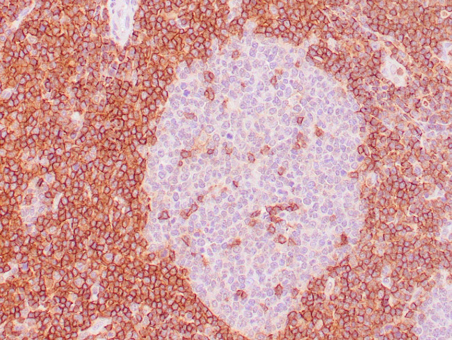 CD43 Antibody in Immunohistochemistry (Paraffin) (IHC (P))
