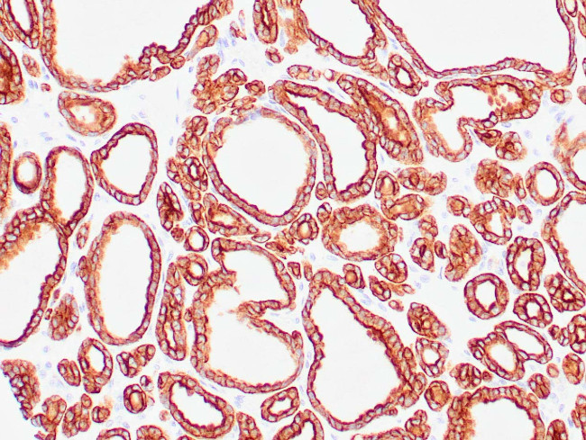 Cytokeratin 18 Antibody in Immunohistochemistry (Paraffin) (IHC (P))