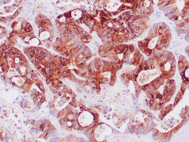 EMA Antibody in Immunohistochemistry (Paraffin) (IHC (P))