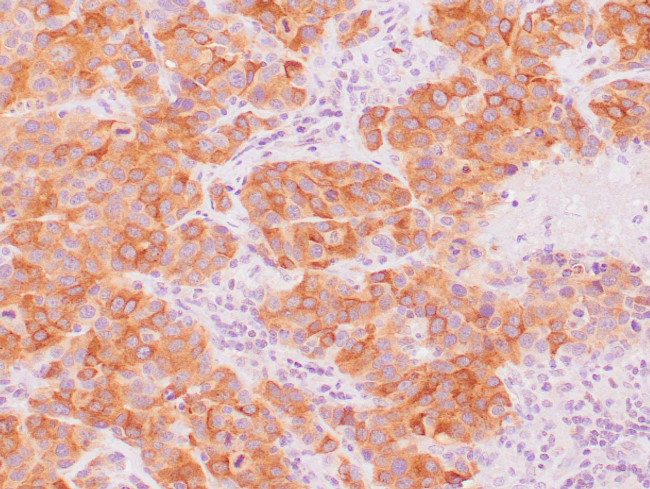 Melan-A Antibody in Immunohistochemistry (Paraffin) (IHC (P))