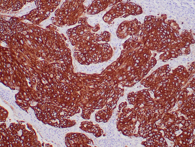 Cytokeratin, Pan Antibody in Immunohistochemistry (Paraffin) (IHC (P))