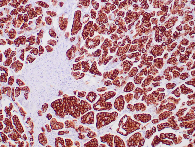 Cytokeratin 7 Antibody in Immunohistochemistry (Paraffin) (IHC (P))