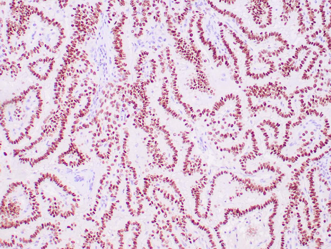 TTF-1/NKX2.1 Antibody in Immunohistochemistry (Paraffin) (IHC (P))