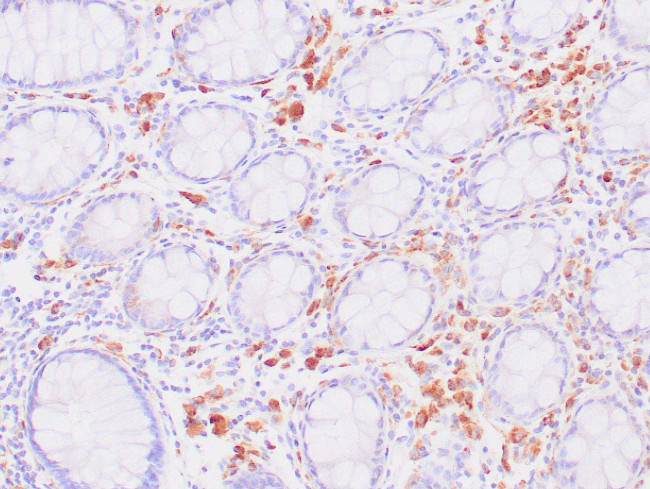 CD68 Antibody in Immunohistochemistry (Paraffin) (IHC (P))