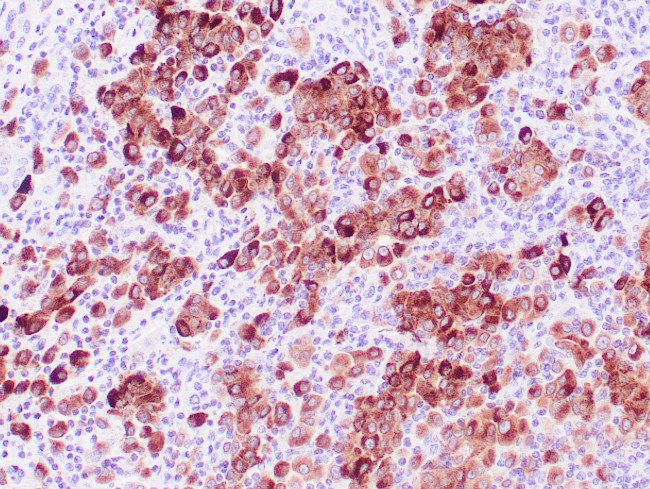 Tyrosinase Antibody in Immunohistochemistry (Paraffin) (IHC (P))