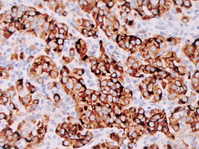 Melanosome Antibody in Immunohistochemistry (Paraffin) (IHC (P))