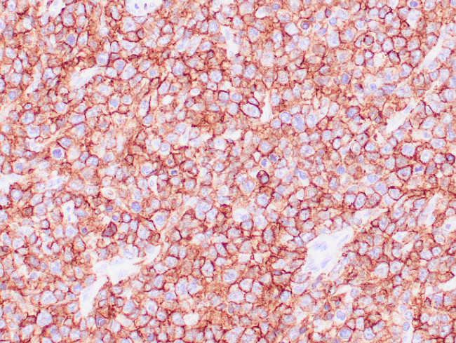 CD45RB Antibody in Immunohistochemistry (Paraffin) (IHC (P))
