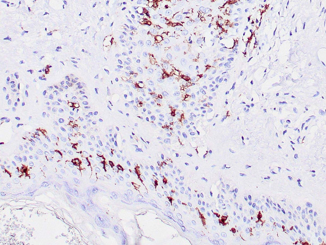 CD1a Antibody in Immunohistochemistry (Paraffin) (IHC (P))