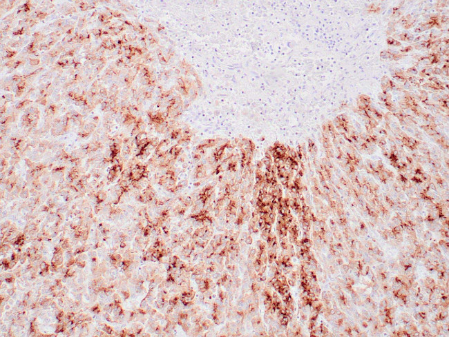 Glypican 3 Antibody in Immunohistochemistry (Paraffin) (IHC (P))