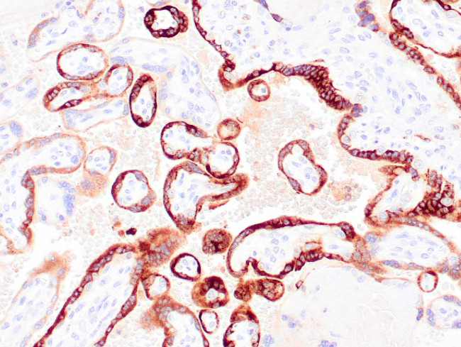HCG Antibody in Immunohistochemistry (Paraffin) (IHC (P))