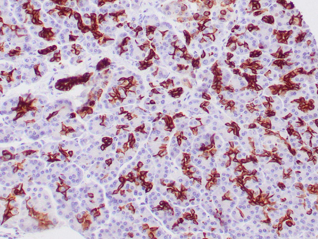 Cytokeratin 19 Antibody in Immunohistochemistry (Paraffin) (IHC (P))