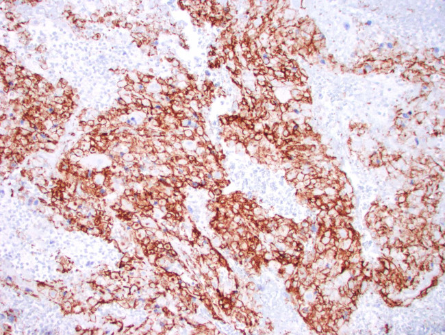CD31 Antibody in Immunohistochemistry (Paraffin) (IHC (P))
