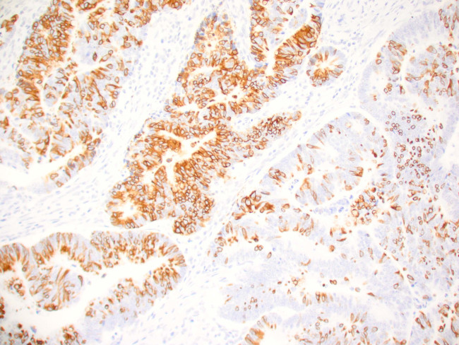 MUC-2 Antibody in Immunohistochemistry (Paraffin) (IHC (P))