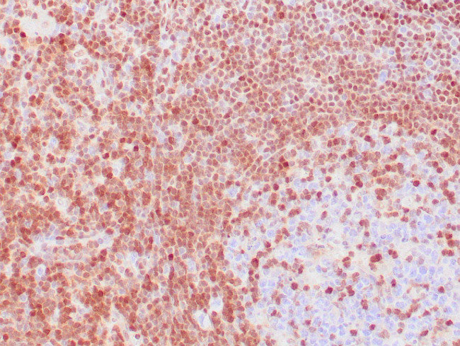 p27kip1 Antibody in Immunohistochemistry (Paraffin) (IHC (P))