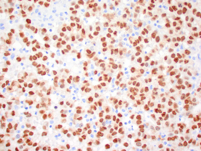 MiTF Antibody in Immunohistochemistry (Paraffin) (IHC (P))