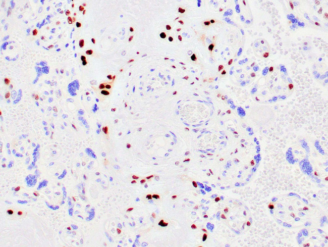p57 Kip2 Antibody in Immunohistochemistry (Paraffin) (IHC (P))
