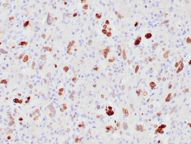 MDM2 Antibody in Immunohistochemistry (Paraffin) (IHC (P))