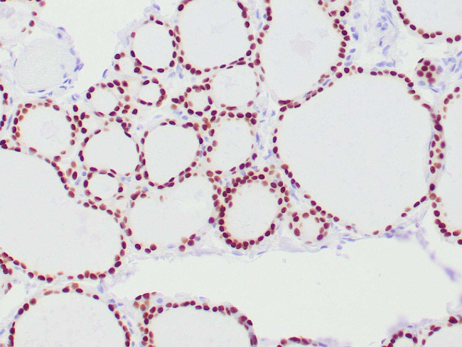 PAX-8 Antibody in Immunohistochemistry (Paraffin) (IHC (P))