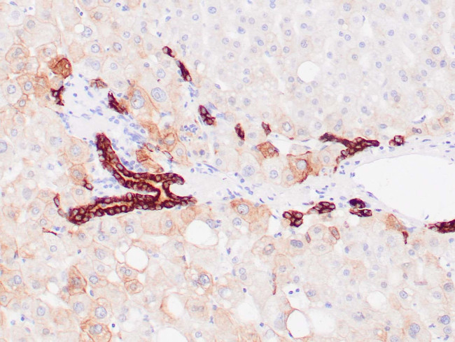 Cytokeratin 8/18 Antibody in Immunohistochemistry (Paraffin) (IHC (P))