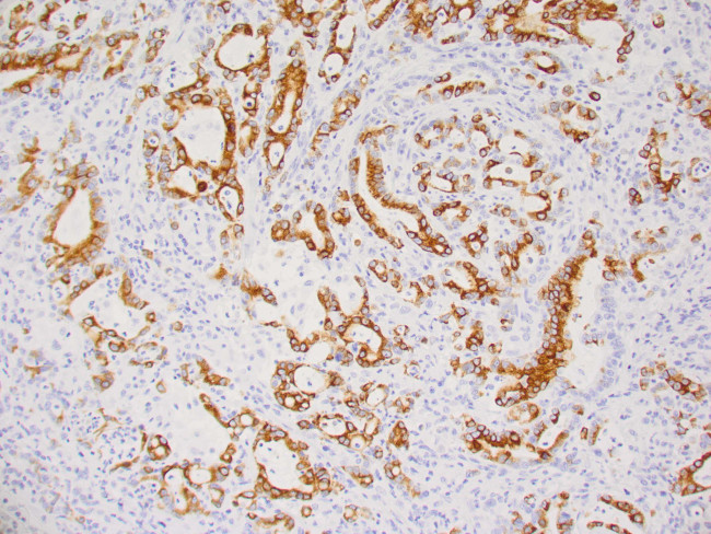 Cytokeratin 17 Antibody in Immunohistochemistry (Paraffin) (IHC (P))