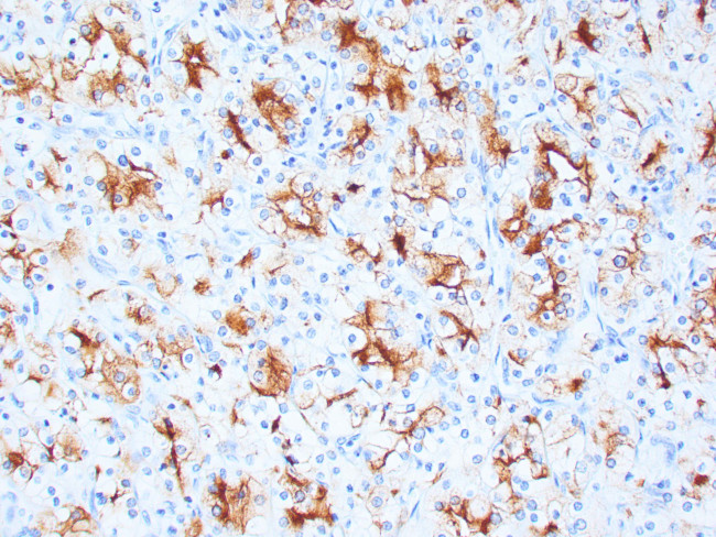 RCC Antibody in Immunohistochemistry (Paraffin) (IHC (P))