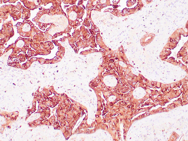 Napsin-A Antibody in Immunohistochemistry (Paraffin) (IHC (P))