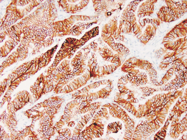 EP-CAM Antibody in Immunohistochemistry (Paraffin) (IHC (P))