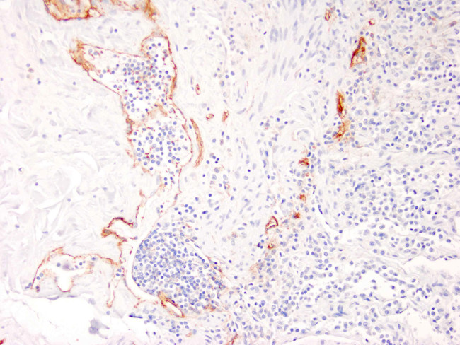 Podoplanin Antibody in Immunohistochemistry (Paraffin) (IHC (P))