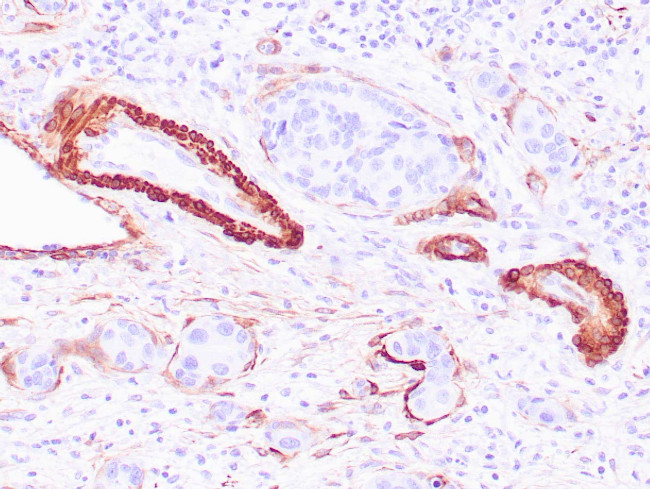 Calponin-1 Antibody in Immunohistochemistry (Paraffin) (IHC (P))