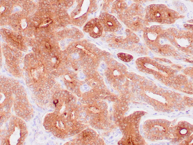 PSA Antibody in Immunohistochemistry (Paraffin) (IHC (P))