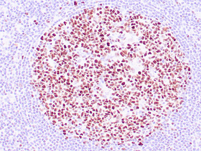BCL-6 Antibody in Immunohistochemistry (Paraffin) (IHC (P))