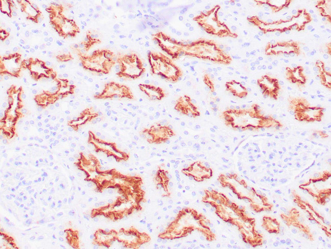 CA IX Antibody in Immunohistochemistry (Paraffin) (IHC (P))