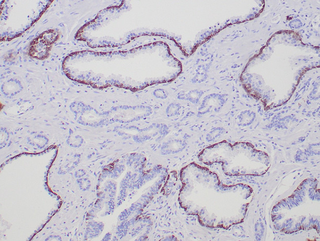 Cytokeratin 5/6 Antibody in Immunohistochemistry (Paraffin) (IHC (P))