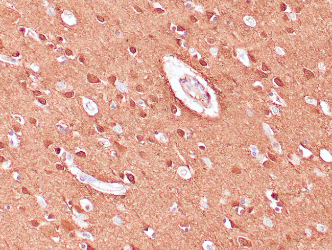 NSE Antibody in Immunohistochemistry (Paraffin) (IHC (P))