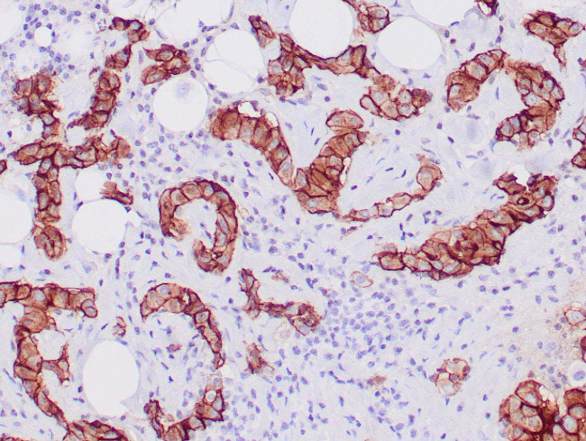 Mesothelin Antibody in Immunohistochemistry (Paraffin) (IHC (P))