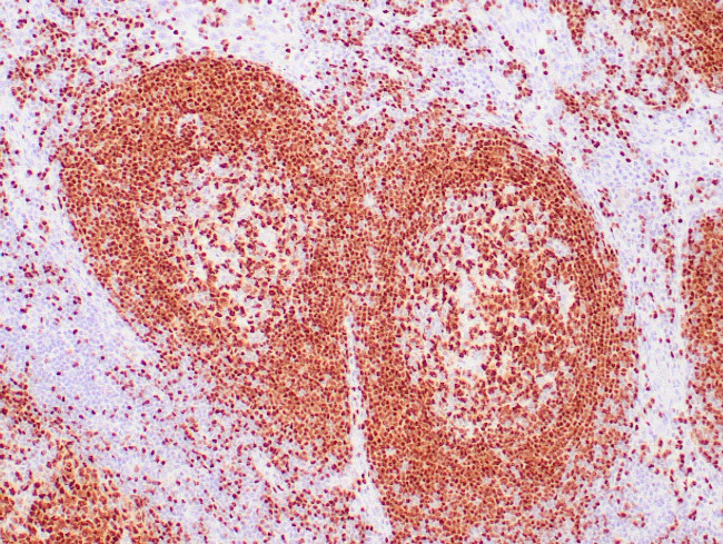 PAX-5 Antibody in Immunohistochemistry (Paraffin) (IHC (P))