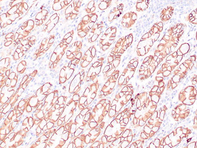 Beta-catenin Antibody in Immunohistochemistry (Paraffin) (IHC (P))