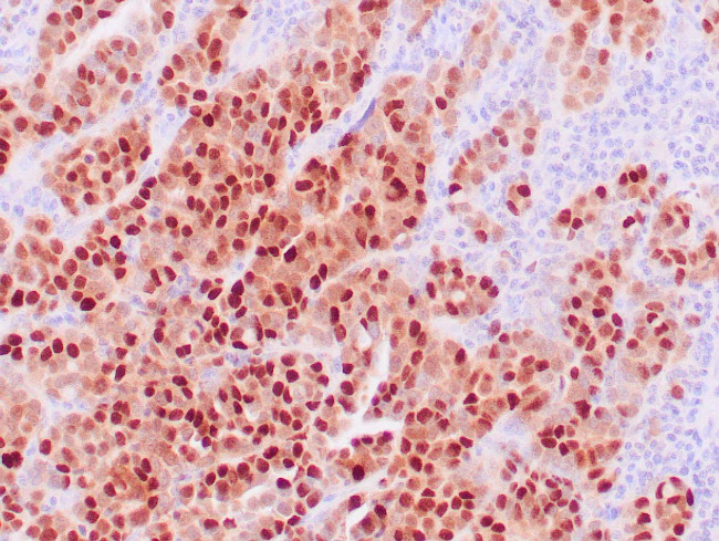 PAX-8 Antibody in Immunohistochemistry (Paraffin) (IHC (P))