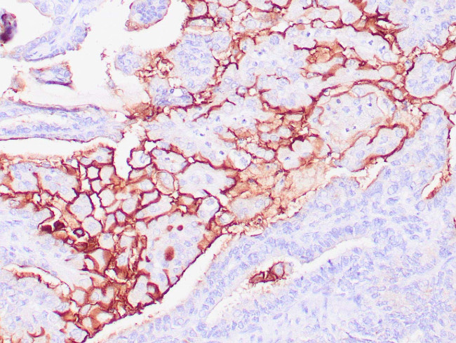 CA125 / MUC16 Antibody in Immunohistochemistry (Paraffin) (IHC (P))