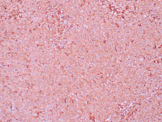 NGFR Antibody in Immunohistochemistry (Paraffin) (IHC (P))