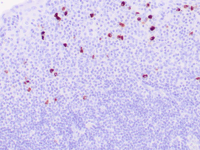 IgG4 Antibody in Immunohistochemistry (Paraffin) (IHC (P))