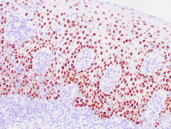SOX-2 Antibody in Immunohistochemistry (Paraffin) (IHC (P))