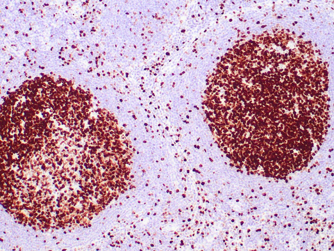 Ki-67 Antibody in Immunohistochemistry (Paraffin) (IHC (P))