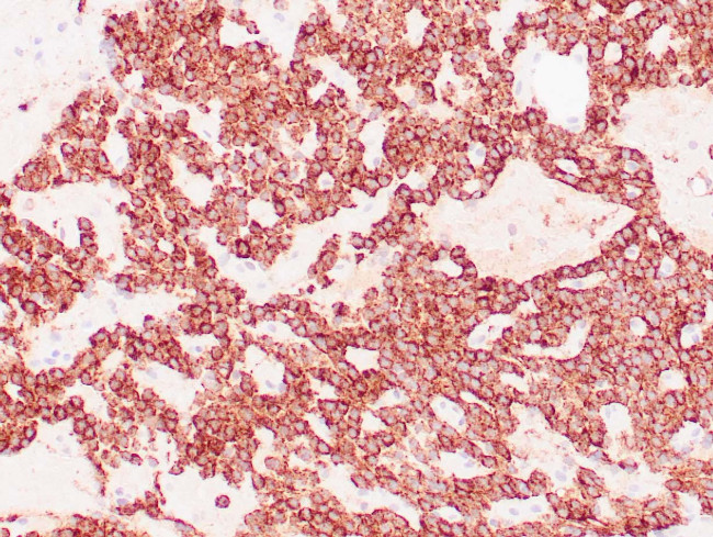 Parathyroid hormone Antibody in Immunohistochemistry (Paraffin) (IHC (P))