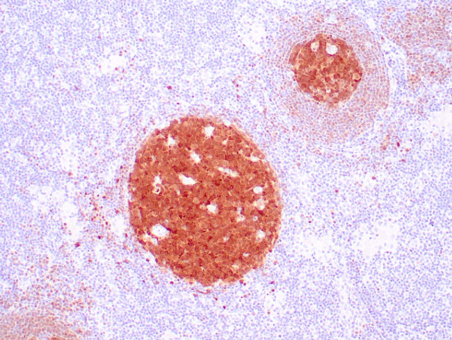 BOB1 Antibody in Immunohistochemistry (Paraffin) (IHC (P))