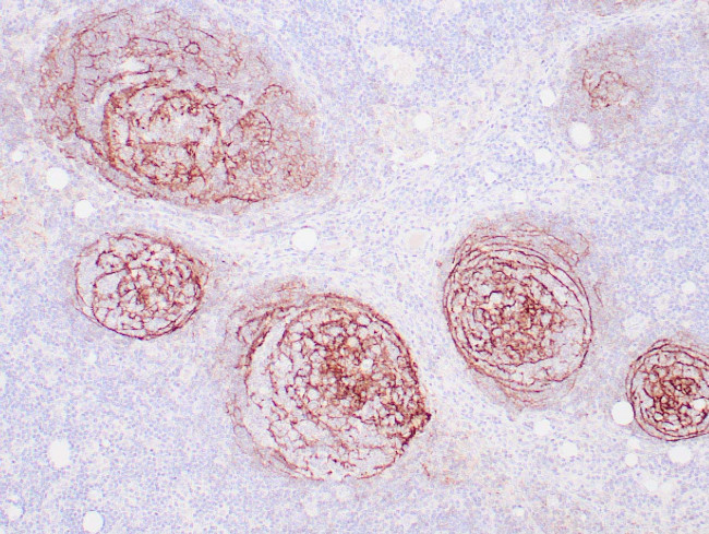 CD21 Antibody in Immunohistochemistry (Paraffin) (IHC (P))